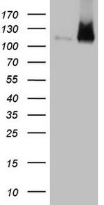 LIMA1 Antibody in Western Blot (WB)