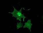 LIMK1 Antibody in Immunocytochemistry (ICC/IF)