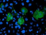 LIMK1 Antibody in Immunocytochemistry (ICC/IF)