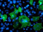 LIMK1 Antibody in Immunocytochemistry (ICC/IF)