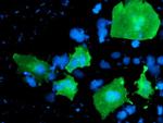 LIMK1 Antibody in Immunocytochemistry (ICC/IF)