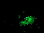 LIMK1 Antibody in Immunocytochemistry (ICC/IF)