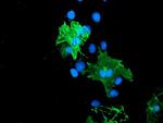 LIMK1 Antibody in Immunocytochemistry (ICC/IF)