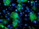 LIMK1 Antibody in Immunocytochemistry (ICC/IF)