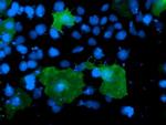 LIMK1 Antibody in Immunocytochemistry (ICC/IF)