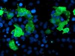 LIMK1 Antibody in Immunocytochemistry (ICC/IF)