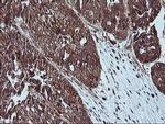 LIMK1 Antibody in Immunohistochemistry (Paraffin) (IHC (P))