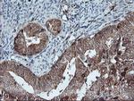 LIMK1 Antibody in Immunohistochemistry (Paraffin) (IHC (P))