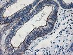 LIMK1 Antibody in Immunohistochemistry (Paraffin) (IHC (P))