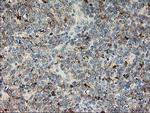 LIMK1 Antibody in Immunohistochemistry (Paraffin) (IHC (P))