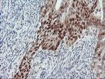 LIMK1 Antibody in Immunohistochemistry (Paraffin) (IHC (P))