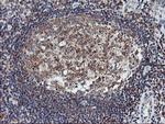 LIMK1 Antibody in Immunohistochemistry (Paraffin) (IHC (P))