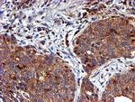 LIMK1 Antibody in Immunohistochemistry (Paraffin) (IHC (P))