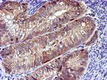 LIMK1 Antibody in Immunohistochemistry (Paraffin) (IHC (P))