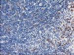 LIMK1 Antibody in Immunohistochemistry (Paraffin) (IHC (P))