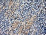 LIMK1 Antibody in Immunohistochemistry (Paraffin) (IHC (P))