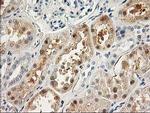 LIMK1 Antibody in Immunohistochemistry (Paraffin) (IHC (P))