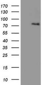 LIMK1 Antibody in Western Blot (WB)