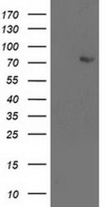 LIMK1 Antibody in Western Blot (WB)