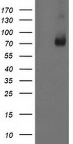 LIMK1 Antibody in Western Blot (WB)