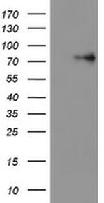 LIMK1 Antibody in Western Blot (WB)