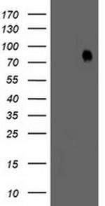 LIMK1 Antibody in Western Blot (WB)