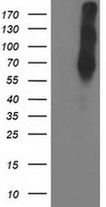 LIMK1 Antibody in Western Blot (WB)