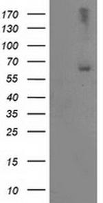 LIMK1 Antibody in Western Blot (WB)