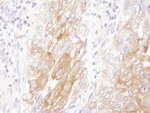 LIN28B Antibody in Immunohistochemistry (IHC)