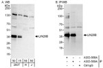 LIN28B Antibody in Western Blot (WB)