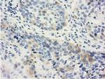 LIN7B Antibody in Immunohistochemistry (Paraffin) (IHC (P))