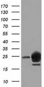 LIN7B Antibody in Western Blot (WB)