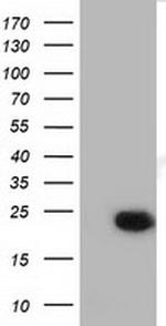 LIN7B Antibody in Western Blot (WB)