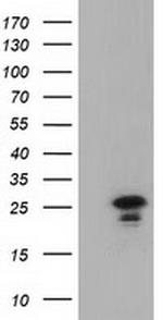 LIN7B Antibody in Western Blot (WB)