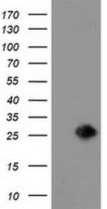 LIN7B Antibody in Western Blot (WB)