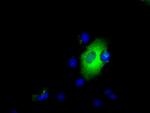 LIPG Antibody in Immunocytochemistry (ICC/IF)