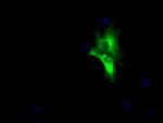 LIPG Antibody in Immunocytochemistry (ICC/IF)