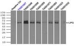 LIPG Antibody in Immunoprecipitation (IP)