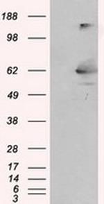 LIPG Antibody in Western Blot (WB)