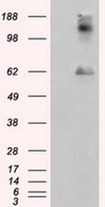 LIPG Antibody in Western Blot (WB)