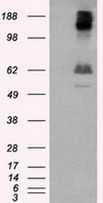 LIPG Antibody in Western Blot (WB)