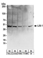 LIS-1 Antibody in Western Blot (WB)