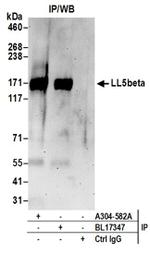 LL5beta Antibody in Western Blot (WB)