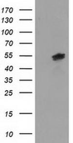 LMAN1 Antibody in Western Blot (WB)