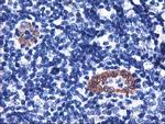 LMCD1 Antibody in Immunohistochemistry (Paraffin) (IHC (P))