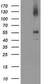 LMCD1 Antibody in Western Blot (WB)