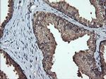 LMO2 Antibody in Immunohistochemistry (Paraffin) (IHC (P))