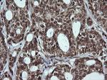 LMO2 Antibody in Immunohistochemistry (Paraffin) (IHC (P))