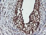 LMO2 Antibody in Immunohistochemistry (Paraffin) (IHC (P))