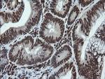 LMO2 Antibody in Immunohistochemistry (Paraffin) (IHC (P))